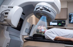 Radiation Therapy